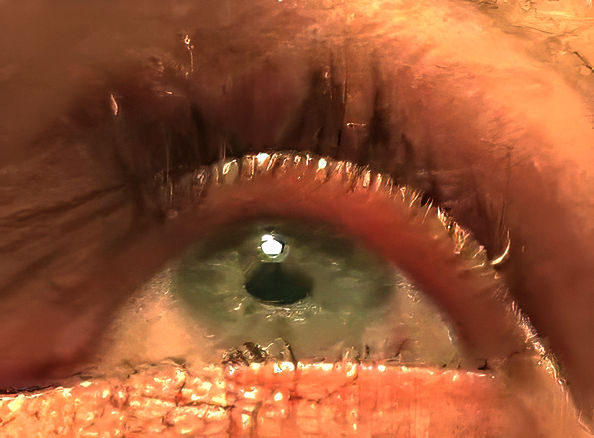 Closeup of my right eye showing my lush eyelashes (thanks to glaucoma medication)